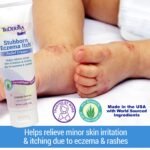 Stubborn Eczema Itch Relief Cream - Image 2