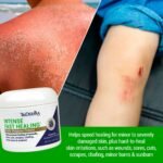 Intense Fast Healing Cream | Medical-Strength Skin Relief for Dry, Damaged & Irritated Skin - Image 3