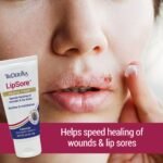 LipSore Healing Cream - Image 2
