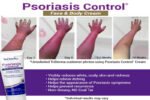 Psoriasis Control Face & Body Cream — 3% Salicylic Acid Relief for Itching, Flaking & Redness - Image 3
