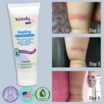 TriDerma Baby Healing All-Purpose Cream - Image 3