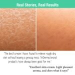 Diabetics Dry Skin Defense Moisturizing Cream - Image 3