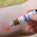 Itch-Stic Power Oil - 100% Natural Relief for Irritated Skin - Image 2