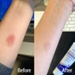 Genuine Aloe Burn Ointment Maximum Strength Topical Burn Relief - Image 3