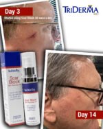 Scar & Stretch Mark Skin Recovery Oil with Cacay – Scar Treatment for Stretch Marks, New & Old Scars | Fast-Absorbing Dry Healing Oil - Image 2
