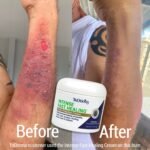 Intense Fast Healing Cream | Medical-Strength Skin Relief for Dry, Damaged & Irritated Skin - Image 2
