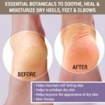 Cracked & Crusty Healthy Foot Cream - Image 3