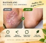 BaiYaoLang Herbal Skin Cream - Image 2